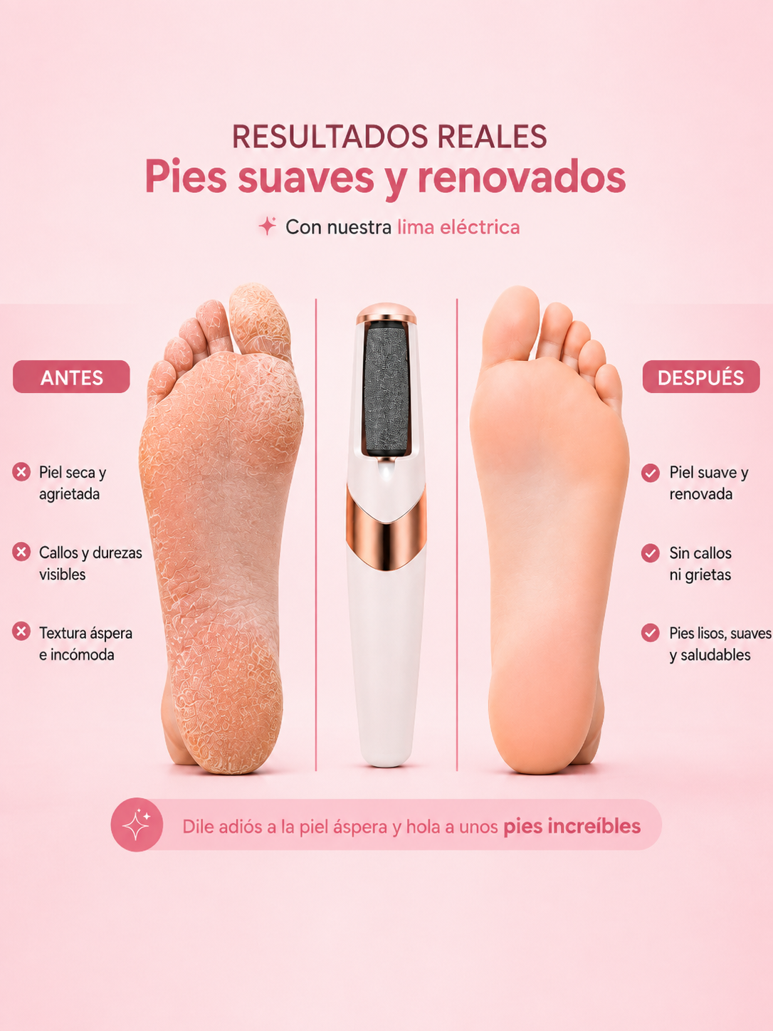 Lima Eléctrica Profesional para Talones – Elimina Durezas en Minutos
