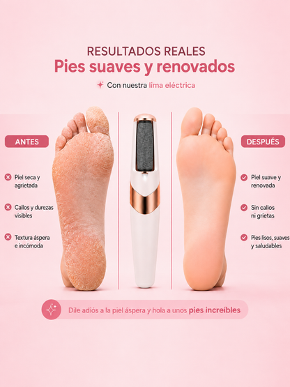 Lima Eléctrica Profesional para Talones – Elimina Durezas en Minutos